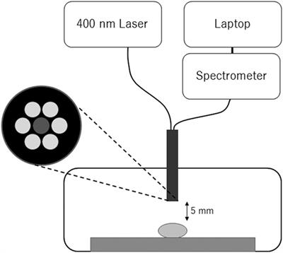 Intraoperative Photodynamic Diagnosis Using Talaporfin Sodium Simultaneously Applied for Photodynamic Therapy against Malignant Glioma: A Prospective Clinical Study